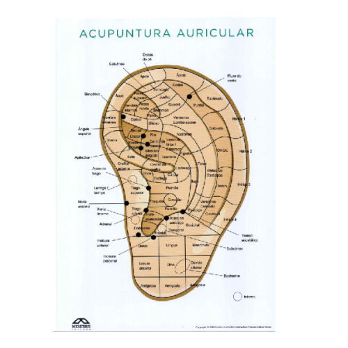 Mapa Acupuntura Auricular Chinesa - Neves