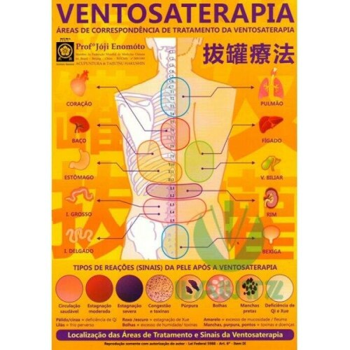 Mapa Ventosaterapia