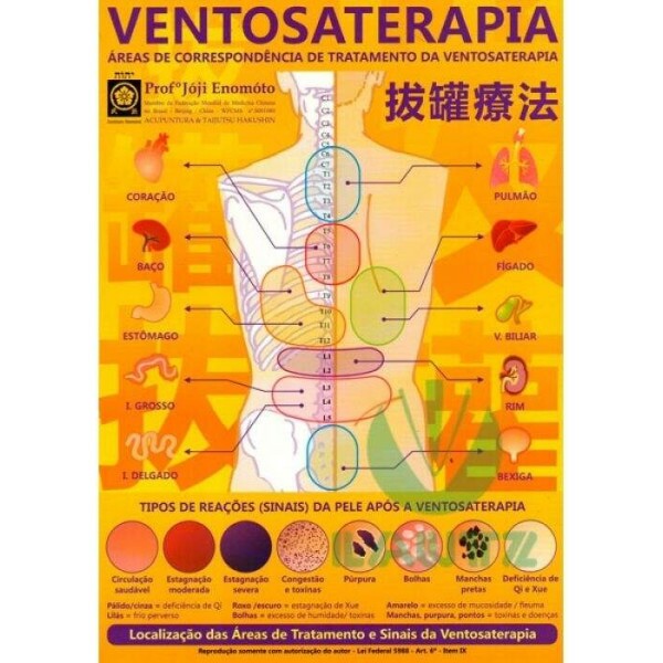 Mapa Ventosaterapia