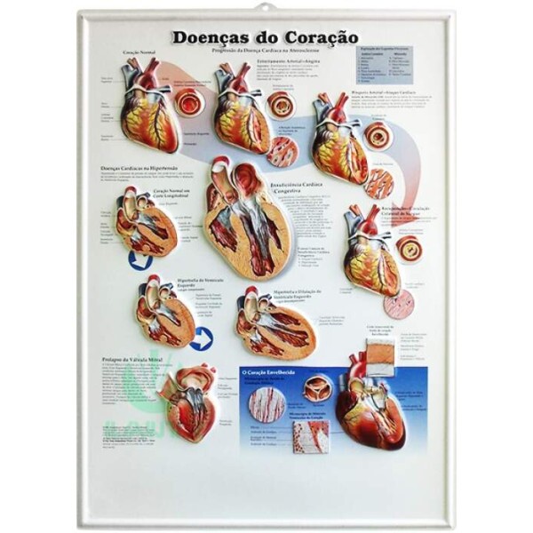 Poster 3D Doen�as do Cora��o em Alto-Relevo.