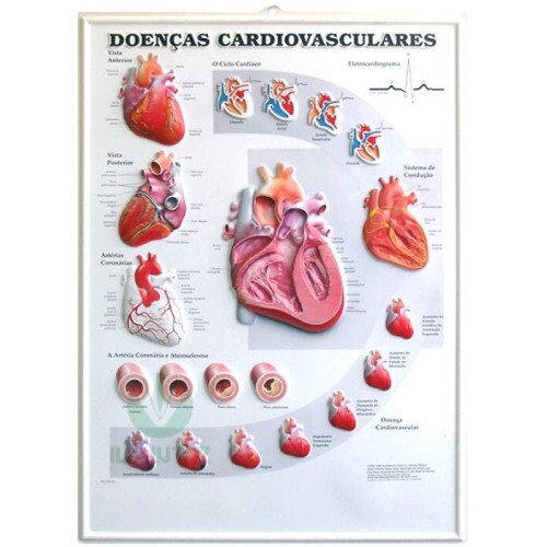 Poster 3D de Doen�as Cardiovasculares em Alto-Relevo