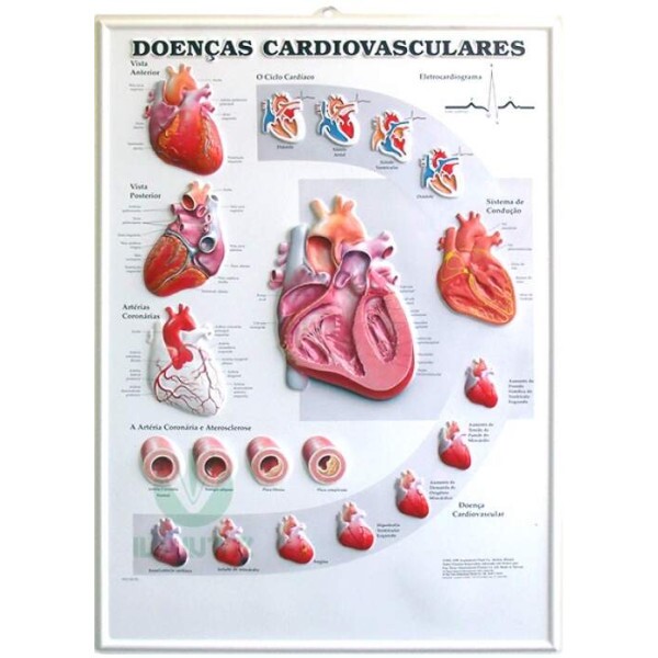 Poster 3D de Doen�as Cardiovasculares em Alto-Relevo